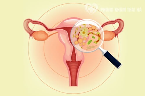 Quan hệ ngày đèn đỏ có hại không? Bí quyết để cuộc yêu thêm hưng phấn 2 quan he ngay den do loveshopaz 2