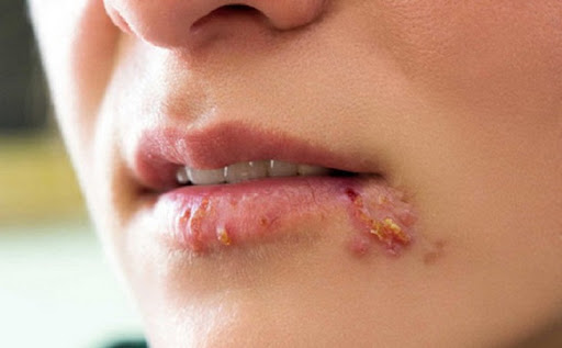 Cum In Alo là gì? Những lợi ích và tác hại của Cum In Alo 3 cum in alo loveshopaz 2