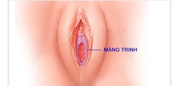 Cách nhận biết màng trinh còn hay rách đơn giản 1 nhận biết màng trinh còn hay rách