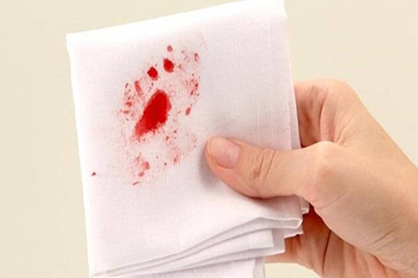 Cách nhận biết màng trinh còn hay rách đơn giản 3 nhan biet mang trinh con hay rach loveshopaz 3