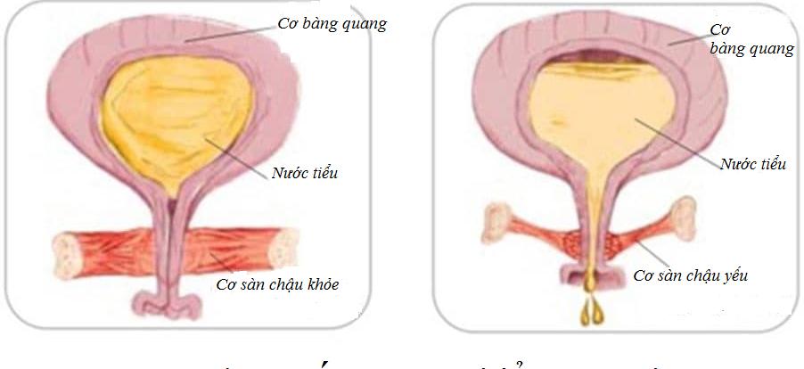 Cách nhận biết cô bé khít chỉ trong vòng một nốt nhạc 2 cach nhan biet co be khit loveshopaz 2